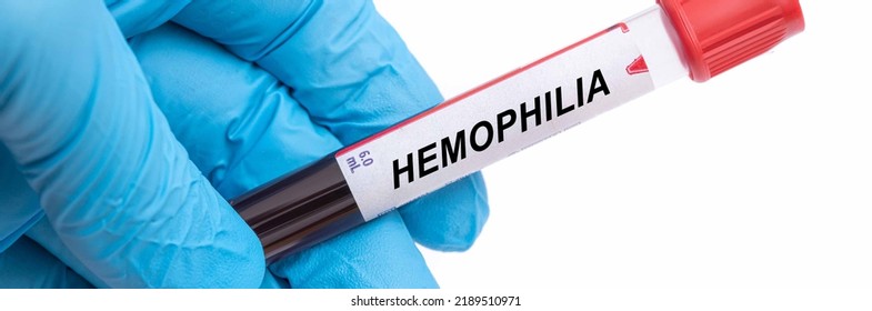 Hemophilia. Hemophilia Disease Blood Test In Doctor Hand