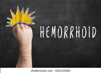 Hemorrhoid Is Not A Death Sentence. Fist And Inscription Hemorrhoid On Chalkboard.