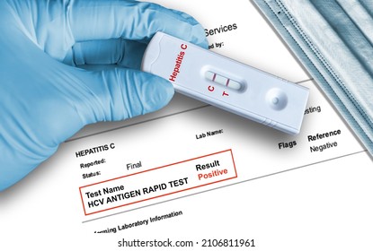 Hepatitis C Positive Antigen Test Result By Using Rapid Self Testing Device Held By Hand In Medical Glove With Medical Face Mask In Background. 