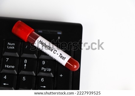 Hepatitis C test to look for abnormalities from blood,  blood sample to analyze in the laboratory, blood in test tube