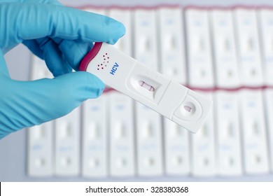 Hepatitis C Virus (HCV) Testing By Using Test Cassette, The Result Showed Positive (double Red Line)
