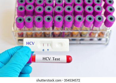 Hepatitis C Virus (HCV) Testing By Using Test Cassette, The Result Showed Positive (double Purple Line)