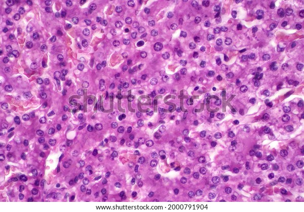 Hepatocyte Cell Main Parenchymal Tissue Liver Stock Photo 2000791904 ...