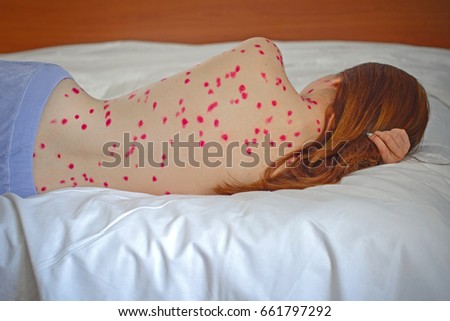 Herpes Women Serious State Health Chickenpox Stock Photo Edit Now