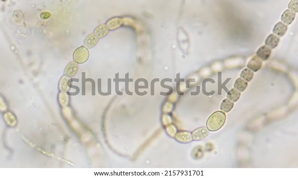 Heterocyst of Anabaena. 400x microscope\
magnification + 4x camera\
zoom