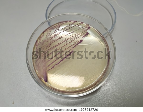 Hi crome, UTI agar\
medium plate which contain violet color colonies of lactose\
fermenting bacteria, E. coli