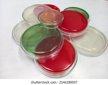 Hichrome uti agar, blood agar, SS agar, TCBS agar media for bacteria culture growth in microbiology room.