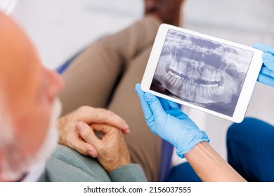 High Angle View Of Doctor Showing Jaw X-ray On Tablet Computer To Patient Sitting At Dental Chair At Dentist Office