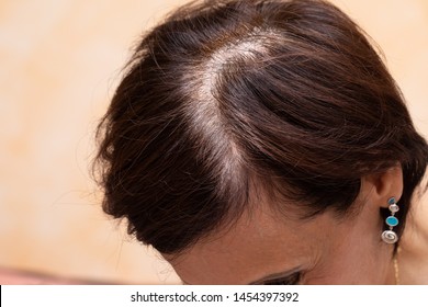 Imagenes Fotos De Stock Y Vectores Sobre Hair Top Of Head