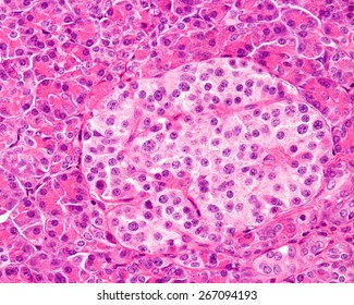 High magnification of a human islet of Langerhans surrounded by exocrine pancreatic acini. Light microscopy. H&E stain.