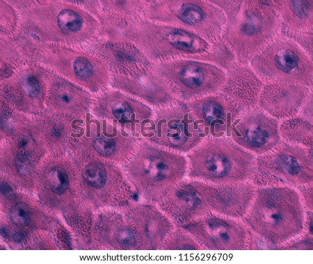 High magnification of keratinocytes of the stratum spinosum of the epidermis. Surrounding each keratinocyte are numerous spiny-like structures, each of which correspond to a desmosome.