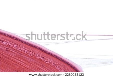 High magnification light micrograph of the eye lens showing the capsule, epithelium and lens fibres. Some zonular fibers, coming from the ciliary body, are inserted in the lens capsule. 
