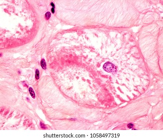 High Magnification Light Micrograph Showing A Purkinje Fiber Of The Heart Conducting System. They Appear As Large Muscle Fibers With Central Nucleus And Very Scarce Myofibrils.