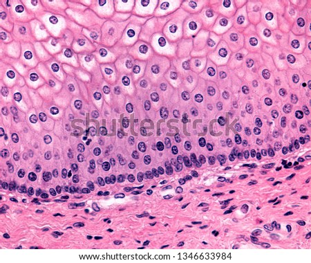 High magnification micrograph of the basal half of the vaginal epithelium. The basal and parabasal layers are evident. Above, the superficial cells show a vacuolated aspect due to glycogen storage.