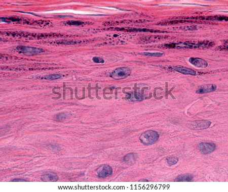 High magnification micrograph of the epidermis showing the transition between the stratum spinosum (with live cells) and the stratum granulosum (with dead cells).
