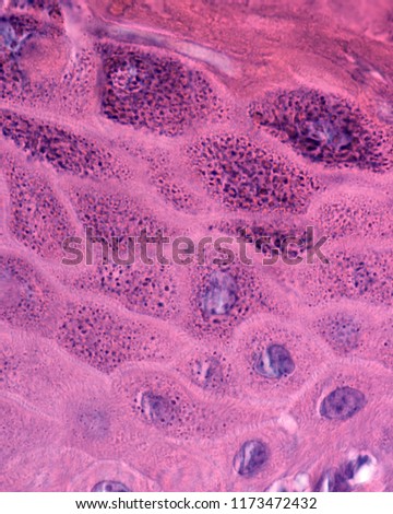 High magnification micrograph of the epidermis showing the stratum granulosum located between the stratum spinosum (bottom) and the stratum corneum (up).