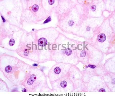 High magnification micrograph of liver cells or hepatocytes showing a large nucleolus stained with eosin. There is a hepatocyte with a large nucleus and other binucleated. These cells are polyploid.