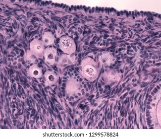 High Magnification Micrograph Showing Primordial Ovarian Follicle With Large Primary Oocytes Surrounded By Flat, Squamous Follicular Cells. The Ovarian Germinal Epithelium Is On Top.