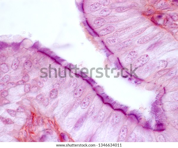 High Magnification Micrograph Showing Simple Columnar Stock Photo (Edit ...