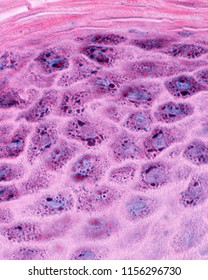High magnification micrograph showing the stratum granulosum of the epidermis. The keratinocytes of this region have numerous keratohyalin granules inside.
