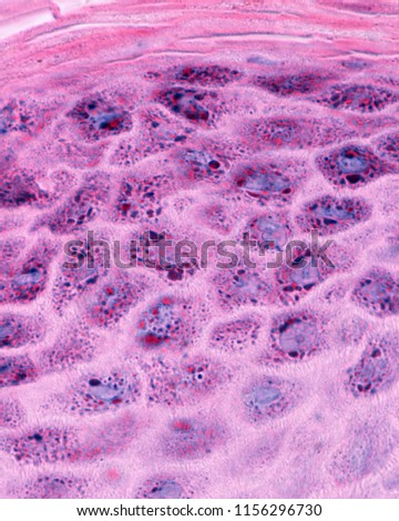 High magnification micrograph showing the stratum granulosum of the epidermis. The keratinocytes of this region have numerous keratohyalin granules inside.