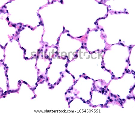 High magnification micrograph showing the typical aspect of the lung parenchyma with many alveoli of very thin walls.
