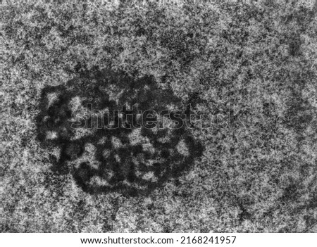 High magnification TEM micrograph of the nucleolus of a hepatocyte showing the dense fibrillar component and the granular component.