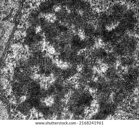 High magnification TEM micrograph of the nucleolus of a hepatocyte showing the dense fibrillar component and the granular component.