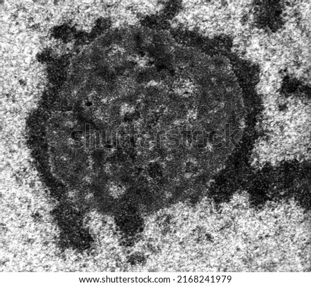 High magnification TEM micrograph of the nucleolus of a hepatocyte showing the dense fibrillar component and the granular component. The nucleolus is surrounded by dark nucleolus associated chromatin