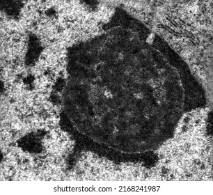 High Magnification TEM Micrograph Showing The Nucleolus Of A Hepatocyte Surrounded By Dark Nucleolus Associated Chromatin