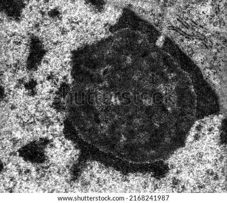 High magnification TEM micrograph showing the nucleolus of a hepatocyte surrounded by dark nucleolus associated chromatin
