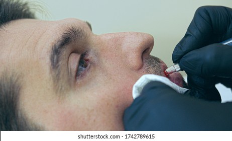 High quality close-up of a man laying on a couch during the esthetician permanent lips treatment.