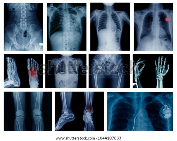 High Quality Collection Xray Image Show Stock Photo (edit Now) 1044107833