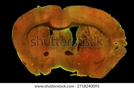 High resolution image of a mouse brain coronal section labeled using immunohistochemistry technique, showing neurons fluorescently labeled in green and microglia labeled in red