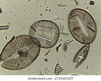 High Resolution Microscopic Study of Ornate Diatom Silica Frustules and Aquatic Microorganisms