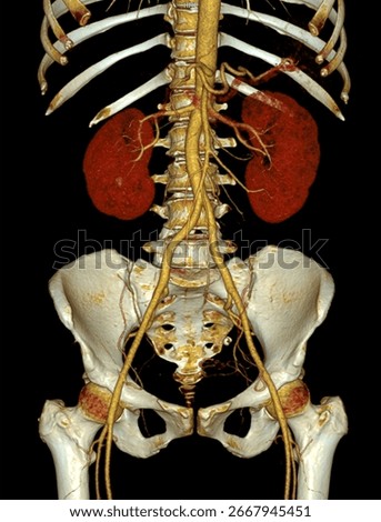 High-quality 3D CTA image of abdominal arteries showing complete vascular anatomy, ideal for radiology, surgical planning, and medical education.