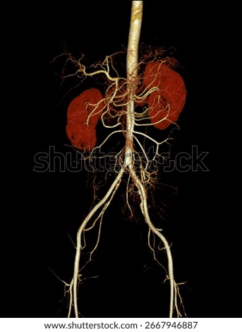 High-quality 3D CTA image of abdominal arteries showing complete vascular anatomy, ideal for radiology, surgical planning, and medical education.