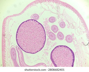 A high-quality microscopic transverse section (t.s.) of an Ascaris roundworm, a common parasite of humans and pigs (man and pig), from a parasitology laboratory slide. Photographed under a light microscope at 100x magnification, this micrograph beautifully shows the internal anatomy, including the thick outer cuticle, muscular layer, intestinal lumen, and reproductive organs filled with developing eggs. Perfect for educational biology textbooks, veterinary science, medical research, and microbiological content