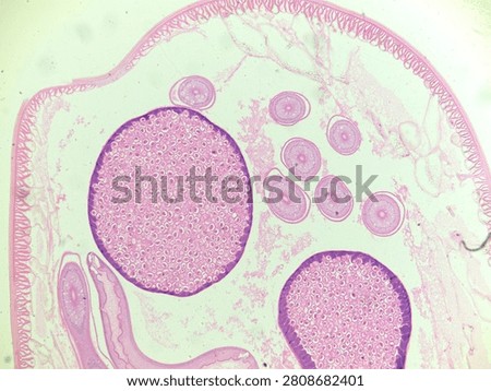 A high-quality microscopic transverse section (t.s.) of an Ascaris roundworm, a common parasite of humans and pigs (man and pig), from a parasitology laboratory slide. Photographed under a light microscope at 100x magnification, this micrograph beautifully shows the internal anatomy, including the thick outer cuticle, muscular layer, intestinal lumen, and reproductive organs filled with developing eggs. Perfect for educational biology textbooks, veterinary science, medical research, and microbiological content
