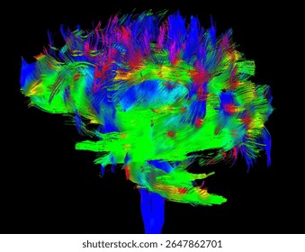 High-resolution MRI DTI (Diffusion Tensor Imaging) scan showing 3D fiber tractography of the human brain.
 Color-coded neural fiber bundles demonstrate white matter connectivity and brain pathways