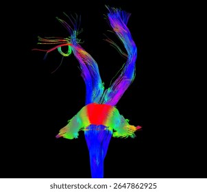 High-resolution MRI DTI (Diffusion Tensor Imaging) scan showing 3D fiber tractography of the human brain.
 Color-coded neural fiber bundles demonstrate white matter connectivity and brain pathways