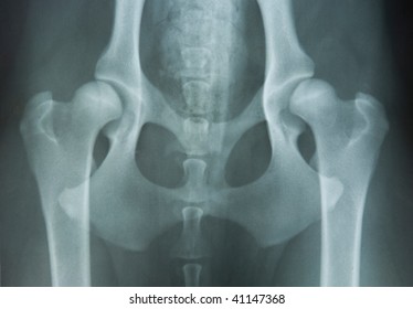 Hip Dysplasia Of An 14 Month Old Hovawart Dog