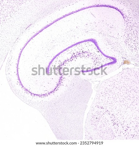 
Hippocampus (allocortex), showing the Ammon horn (curve open to the right), the dentate gyrus (curve open to the left), and, on bottom, the fimbria of hippocampus. Cresyl violet stain.