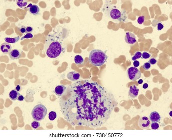 Histiocyte In Mitotic Division