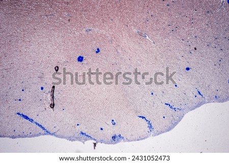 Histological Cerebellum human, Sympathetic ganglion human And Spinal cord human under the microscope for education.