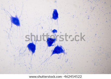 Histological sample Nerve Motor Neuron under the microscope