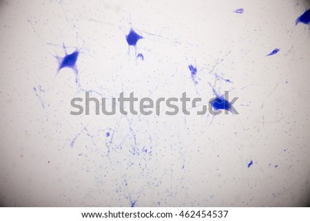 Histological sample Nerve Motor Neuron under the microscope