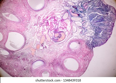 103 Granulosa cell Images, Stock Photos & Vectors | Shutterstock