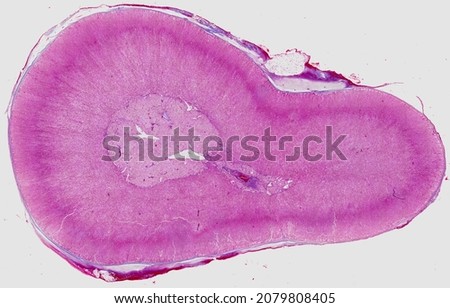 Histological section of the adrenal gland stained with Masson's trichrome.