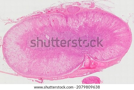 Histological section of the adrenal gland stained with hematoxylin and eosin.